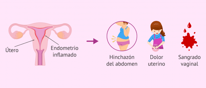 Imagen: Síntomas de la endometritis