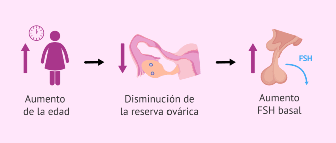 Imagen: Disminución de la reserva ovárica y aumento de la FSH