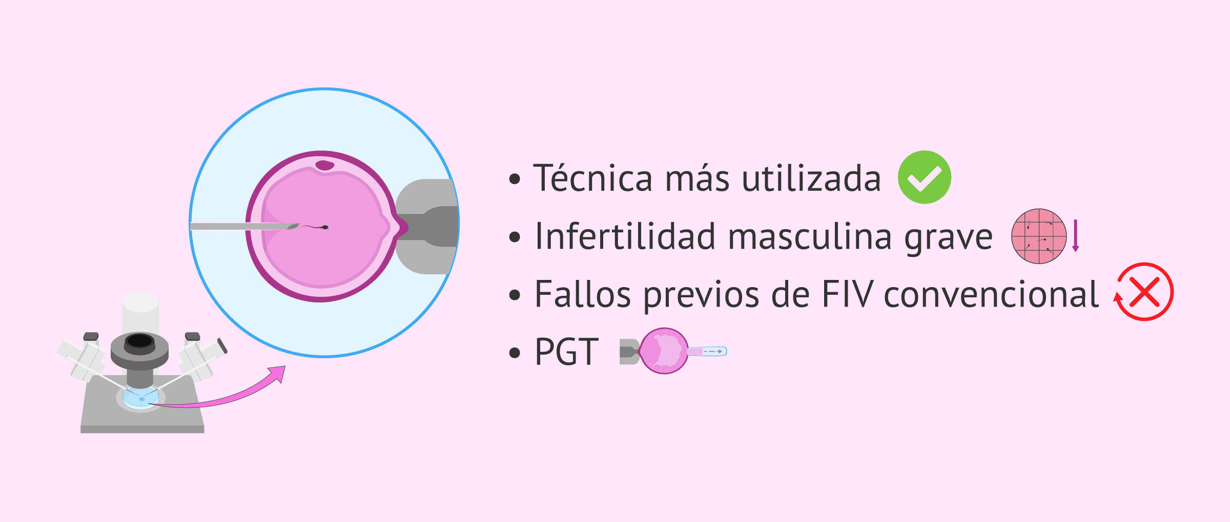 Imagen: Técnica de ICSI e infertilidad femenina