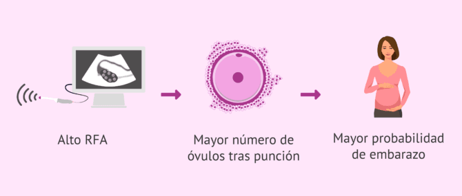 Imagen: Reserva ovárica y resultados en reproducción asistida