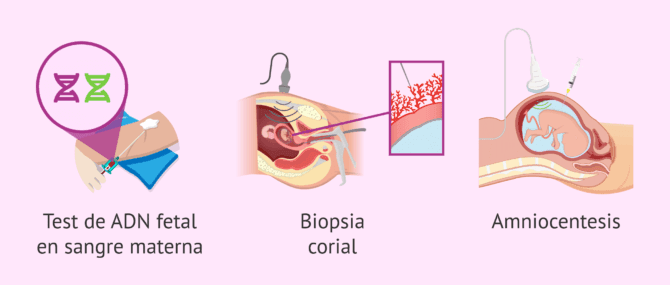 Imagen: ¿Qué estudios prenatales existen?