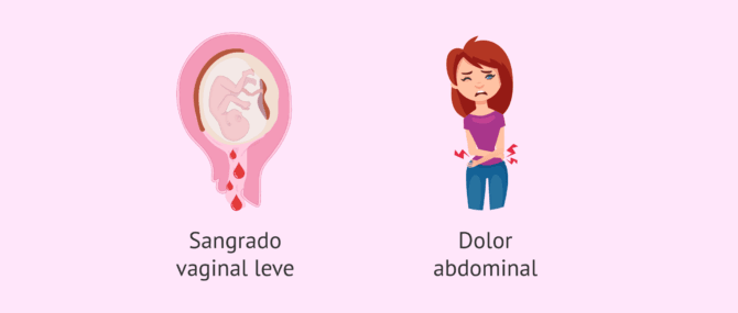 Imagen: Síntomas de la amenaza de aborto