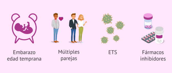 Imagen: Causas de la displasia cervical