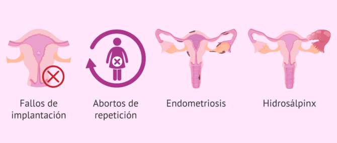 Imagen: ¿Cuándo está recomendado el test endomeTRIO?