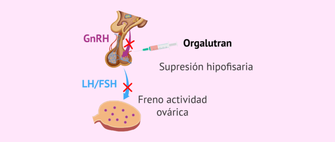 Imagen: ¿Cómo actúa el Orgalutran?