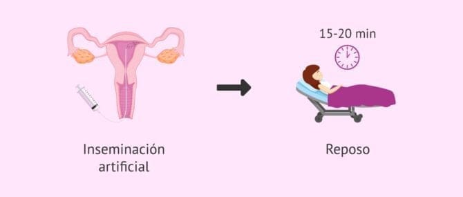 Imagen: Hacer reposo después de la inseminación artificial