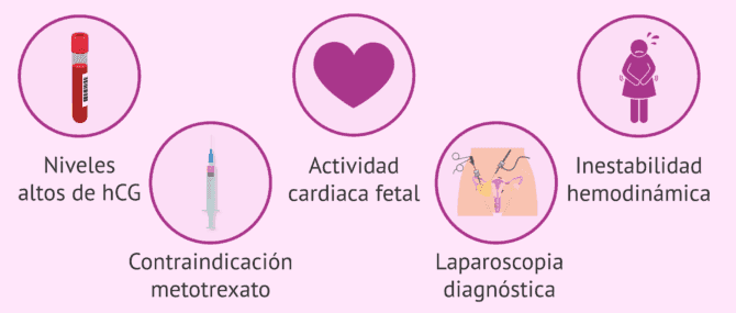 Imagen: Opciones de tratamiento del embarazo ectópico