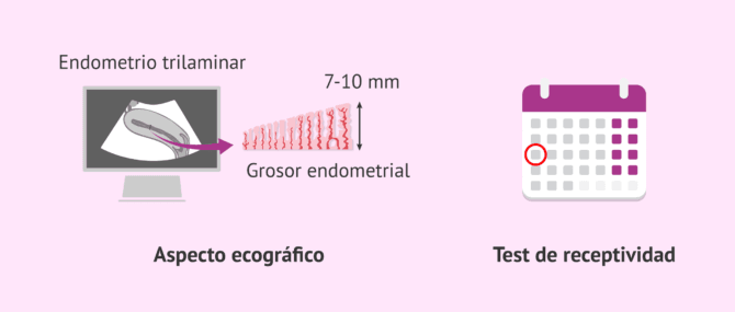 Imagen: Valorar el endometrio ecográficamente y la ventana de implantación