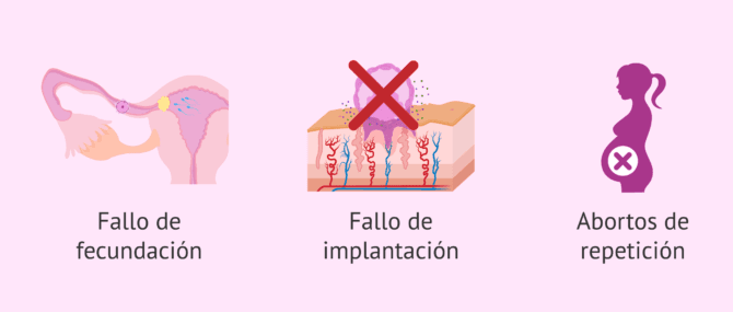 Imagen: ¿Cómo afectan los miomas a la fertilidad?