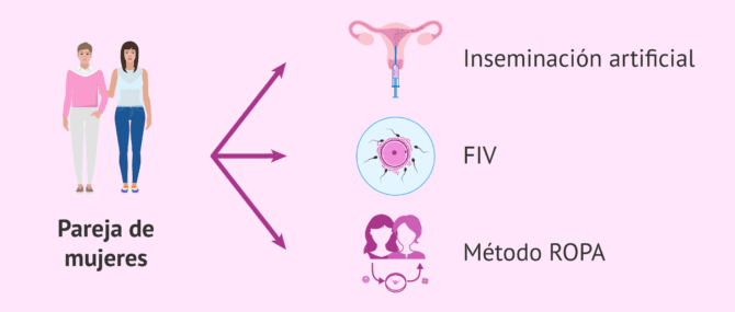 Imagen: Embarazo en parejas de mujeres