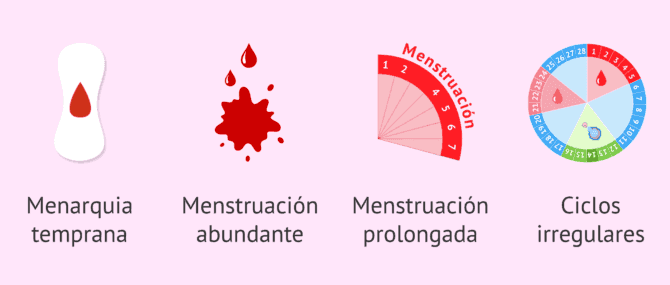 Imagen: Cefalea en la menstruación