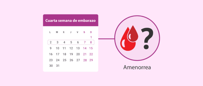 Imagen: Retraso menstrual o amenorrea y embarazo