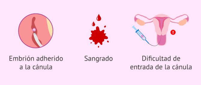 Imagen: Posibles riesgos en la transferencia de embriones