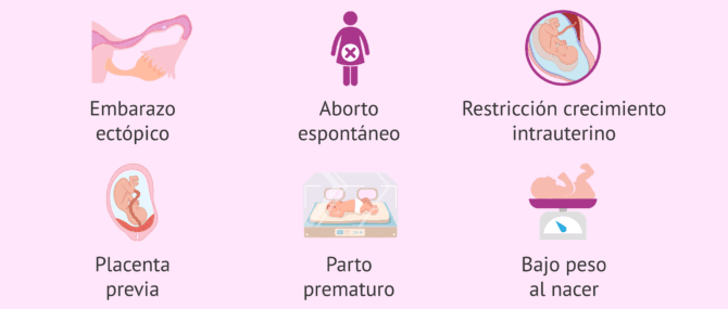 Imagen: ¿Qué complicaciones trae fumar para el embarazo?