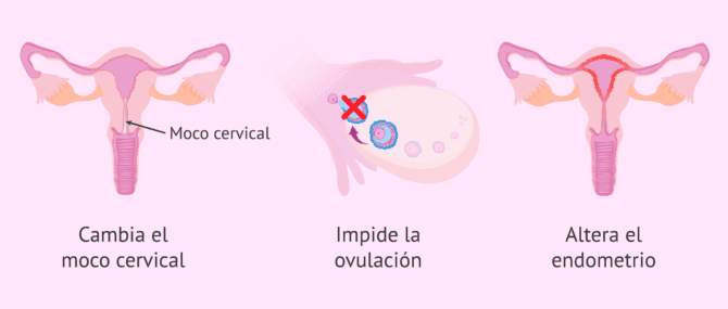 Imagen: ¿Qué hace la píldora anticonceptiva?