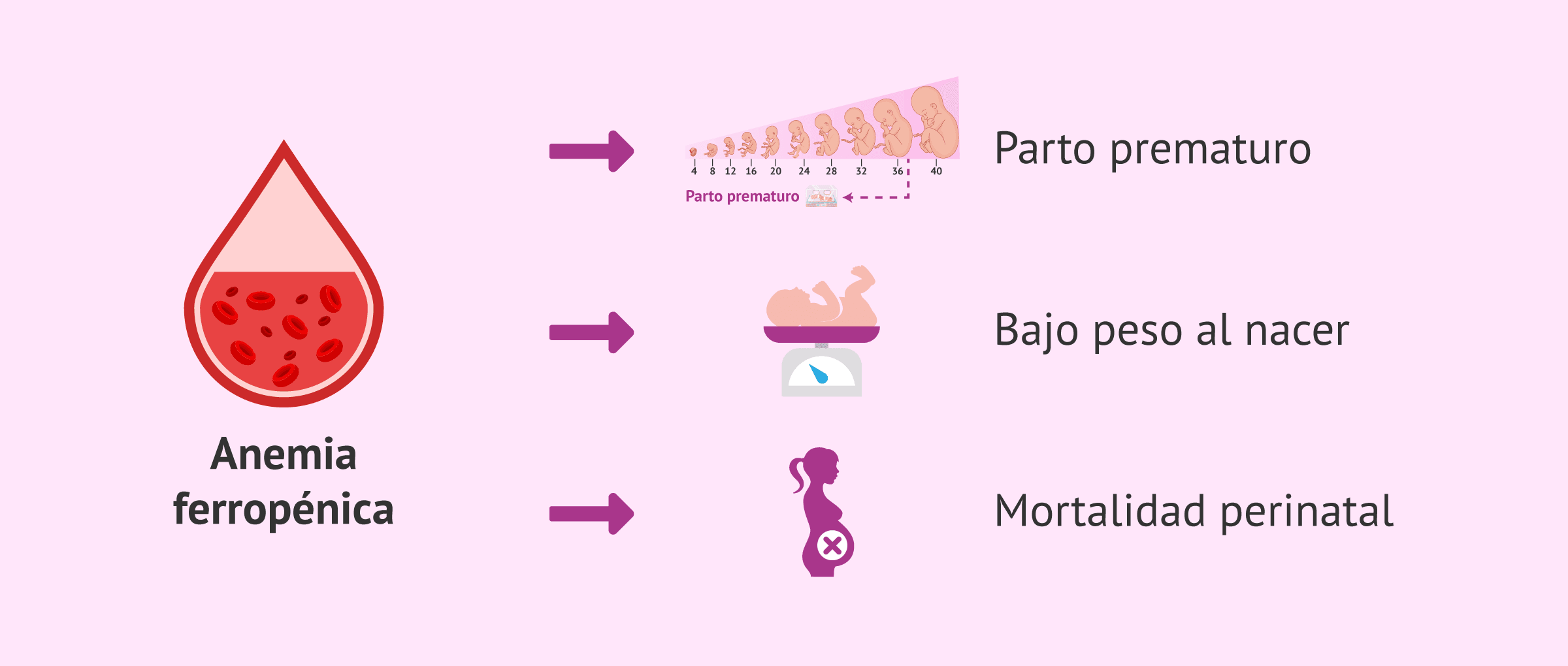 Imagen: Riesgos de la anemia durante el embarazo