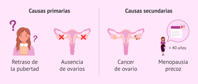 Imagen: Regla irregular