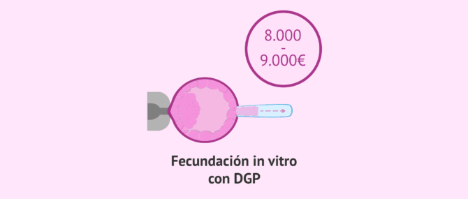 Imagen: ¿Cuál es el precio del DGP o PGT?