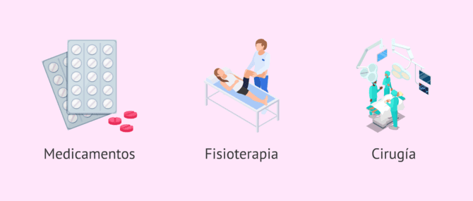 Imagen: ¿Qué tratamientos existen para la artritis reumatoide?