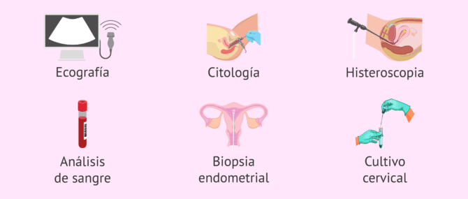 Imagen: Diagnóstico del sangrado intermenstrual