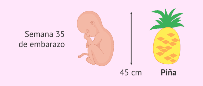 Imagen: Tamaño del bebé en la semana 35 de gestación