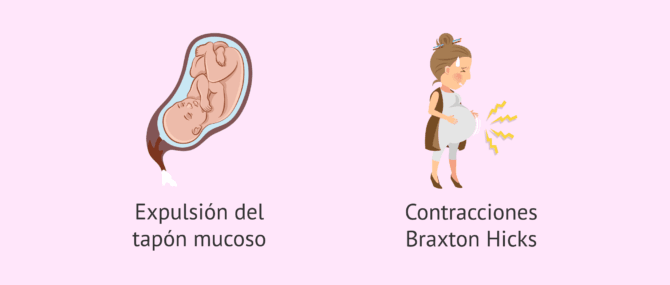 Imagen: ¿Qué puede pasar en la semana 37 de gestación?