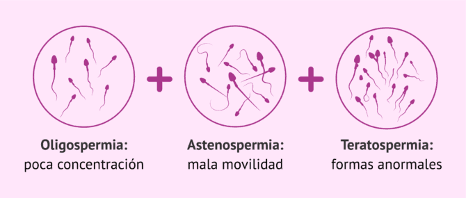 Imagen: ¿Qué significa oligoastenoteratospermia?