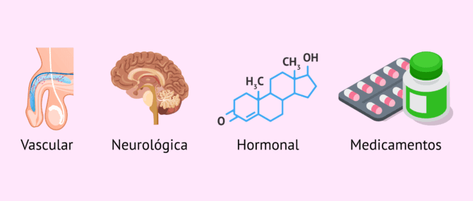 Imagen: ¿Cuáles son las causas orgánicas de la disfunción eréctil?