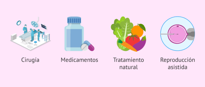 Imagen: Posibles tratamientos de la oligoastenoteratospermia