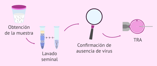 Imagen: Procedimiento del lavado seminal y confirmación de ausencia viral