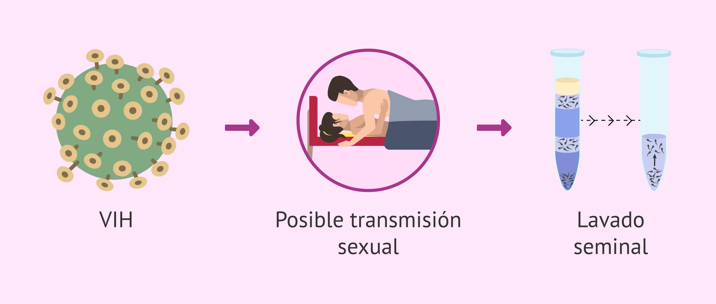 Transmisión sexual del VIH y reproducción asistida