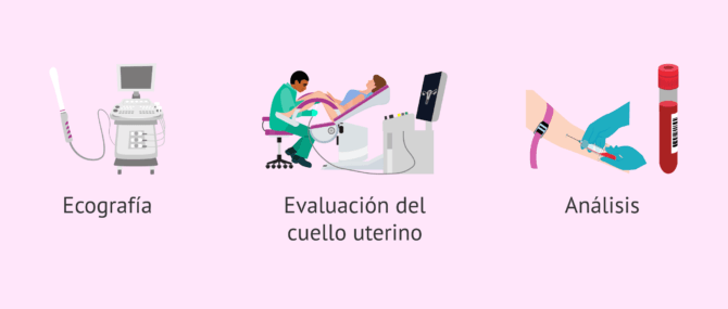 Imagen: ¿Cómo se diagnostica una amenaza de aborto?