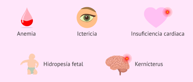 Imagen: Síntomas de la enfermedad hemolítica perinatal