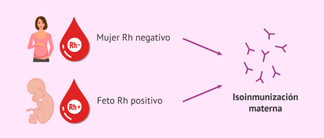 Imagen: ¿Cuándo se produce la isoinmunización materna?