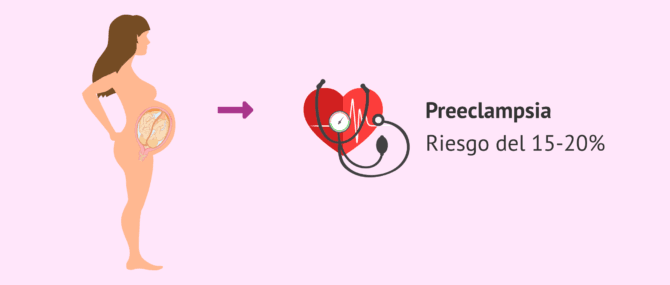 Imagen: Mayor riesgo de preeclampsia en el embarazo múltiple