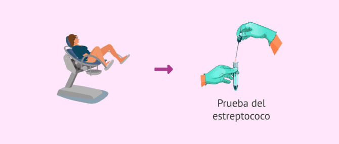 Imagen: Prueba Streptococcus agalactiae