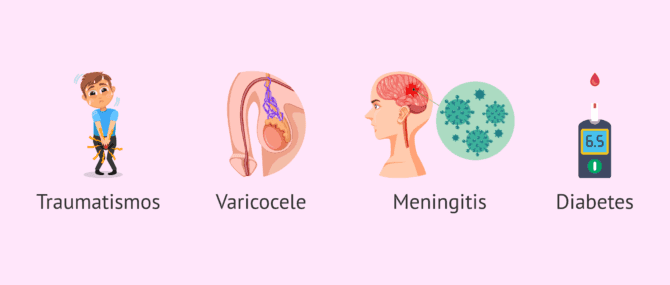 Imagen: Patologías relacionadas con la teratozoospermia