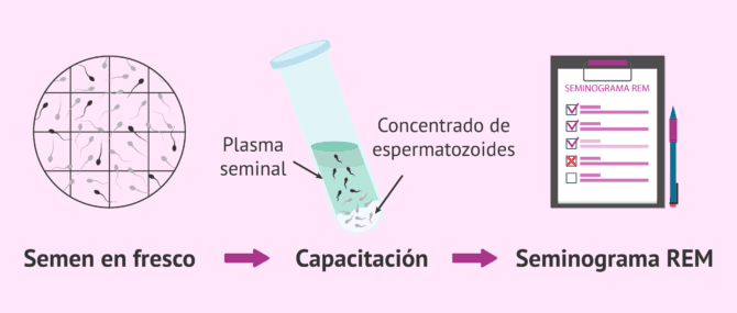 Imagen: Capacitación espermática y seminograma REM