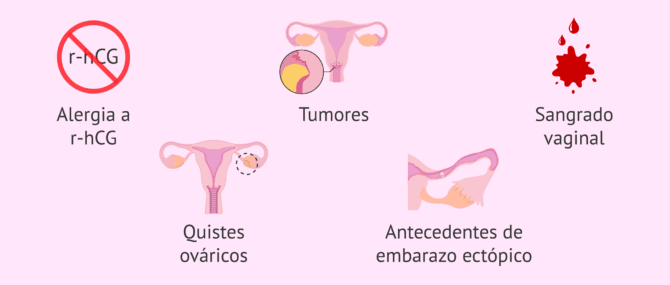 Imagen: ¿Cuándo no se debe administrar Ovitrelle?