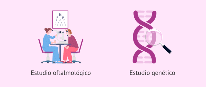 Imagen: Pruebas diagnósticas para la retinosis pigmentaria