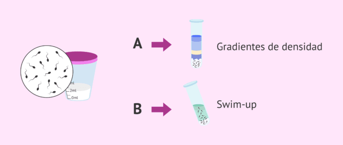 Imagen: Dos métodos para la capacitación espermática in vitro