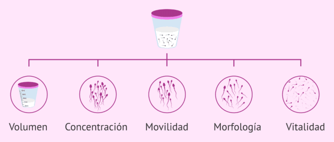 Imagen: Parámetros analizados en el seminograma