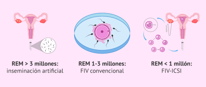 Imagen: Resultados del REM y tratamiento de fertilidad