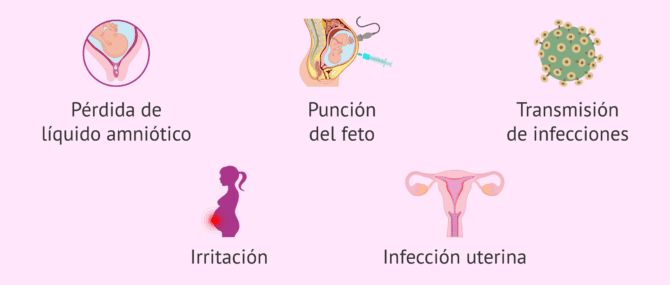 Imagen: Posibles riesgos de la amniocentesis