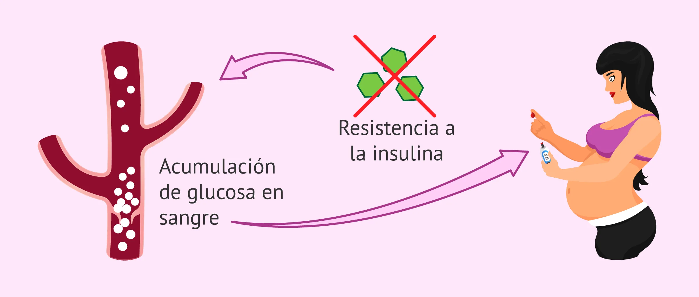 Desarrollo de la diabetes gestacional