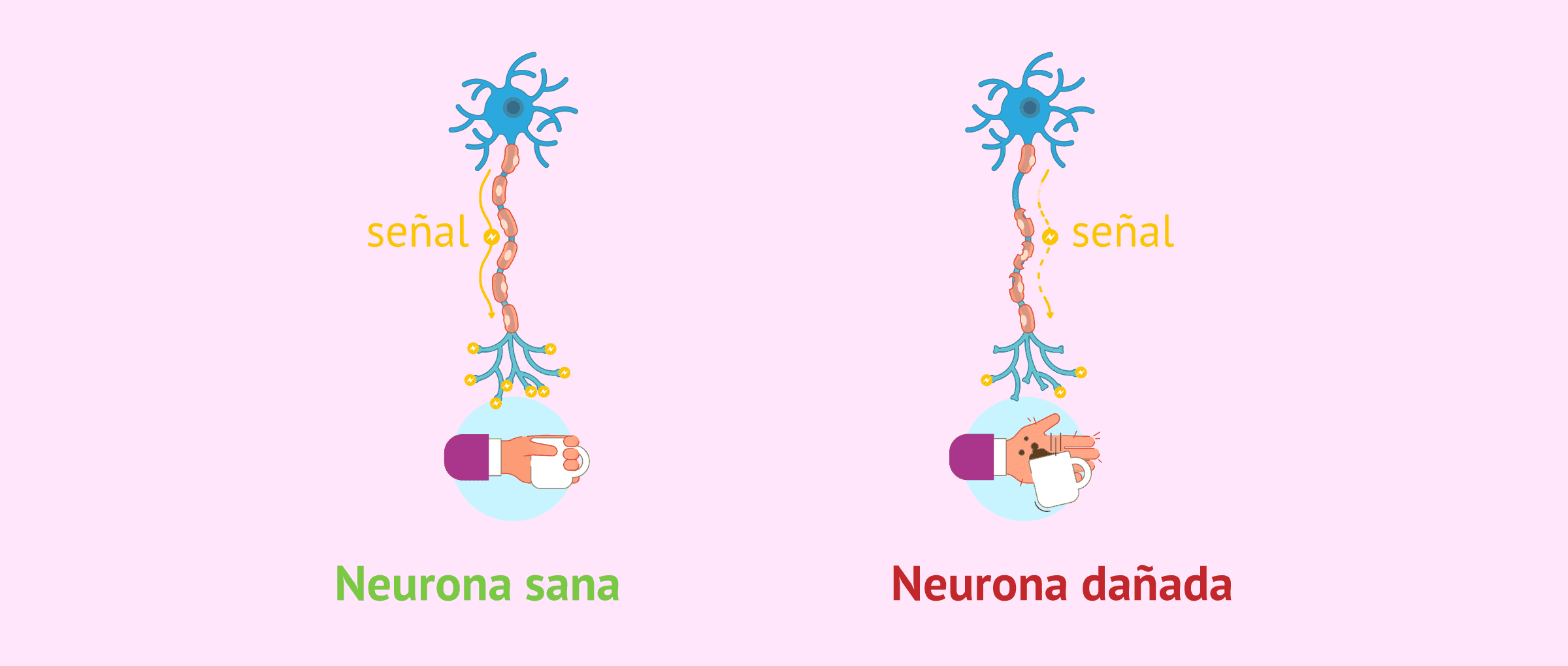 Imagen: Medicación para la esclerosis múltiple