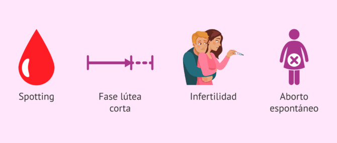 Imagen: Síntomas de la insuficiencia de fase lútea