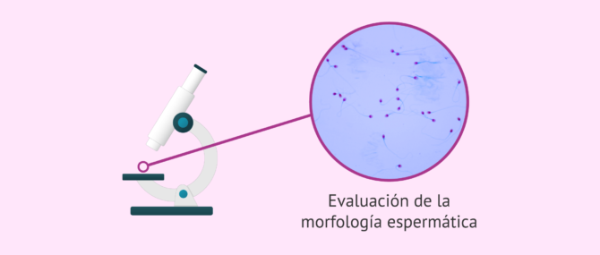 Imagen: Evaluar la morfología de los espermatozoides