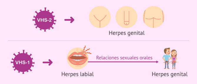 Imagen: ¿Qué virus causa el herpes genital?