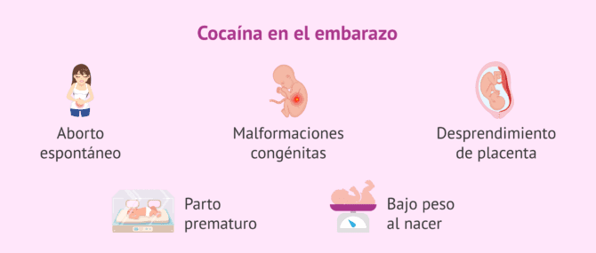 Imagen: Cocaína y embarazo